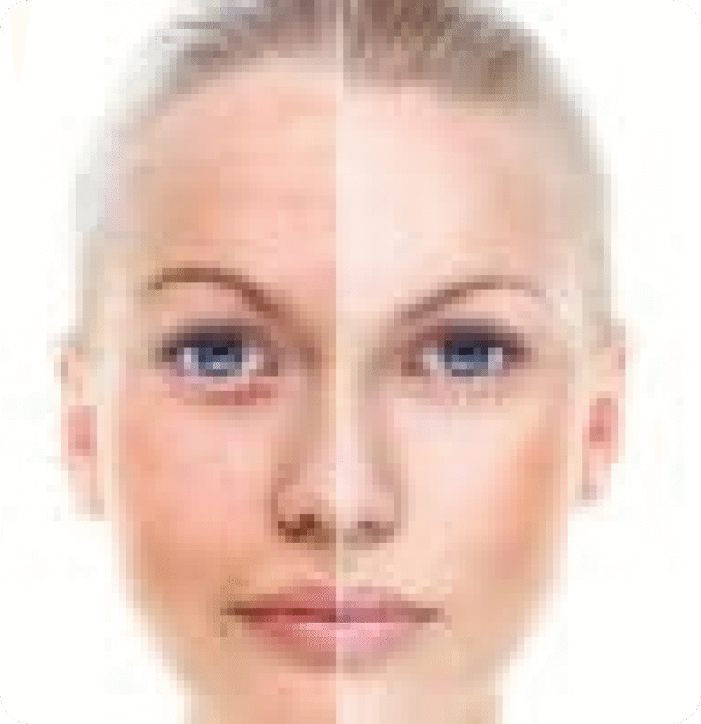 Dermacell Microdermabrasion (Refurbished) - Image 3