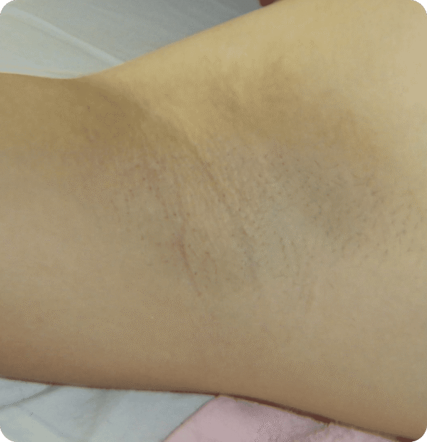 Advanced GSD IPL sPTF+ - Image 2