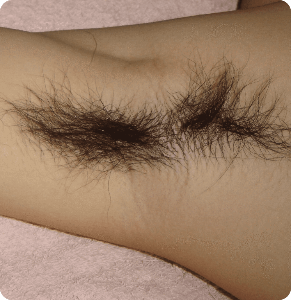 Advanced GSD IPL sPTF+ - Image 3