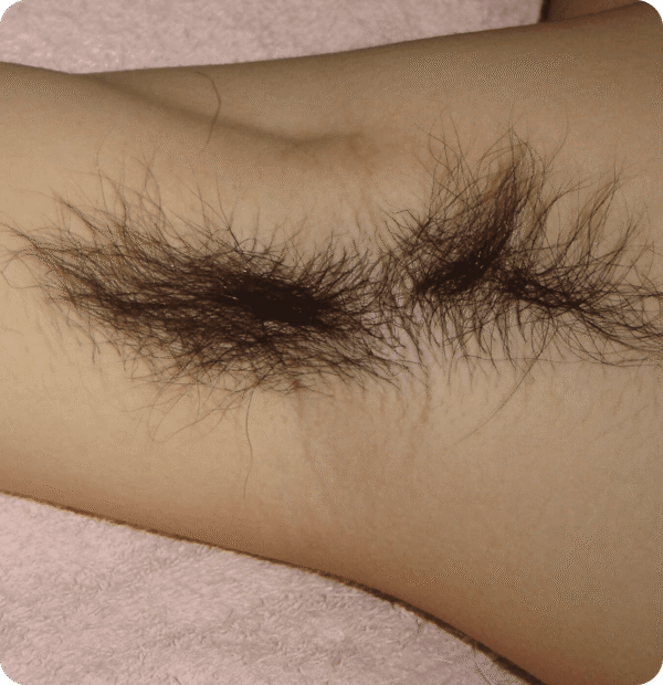 Advanced GSD IPL sPTF+ - Image 3