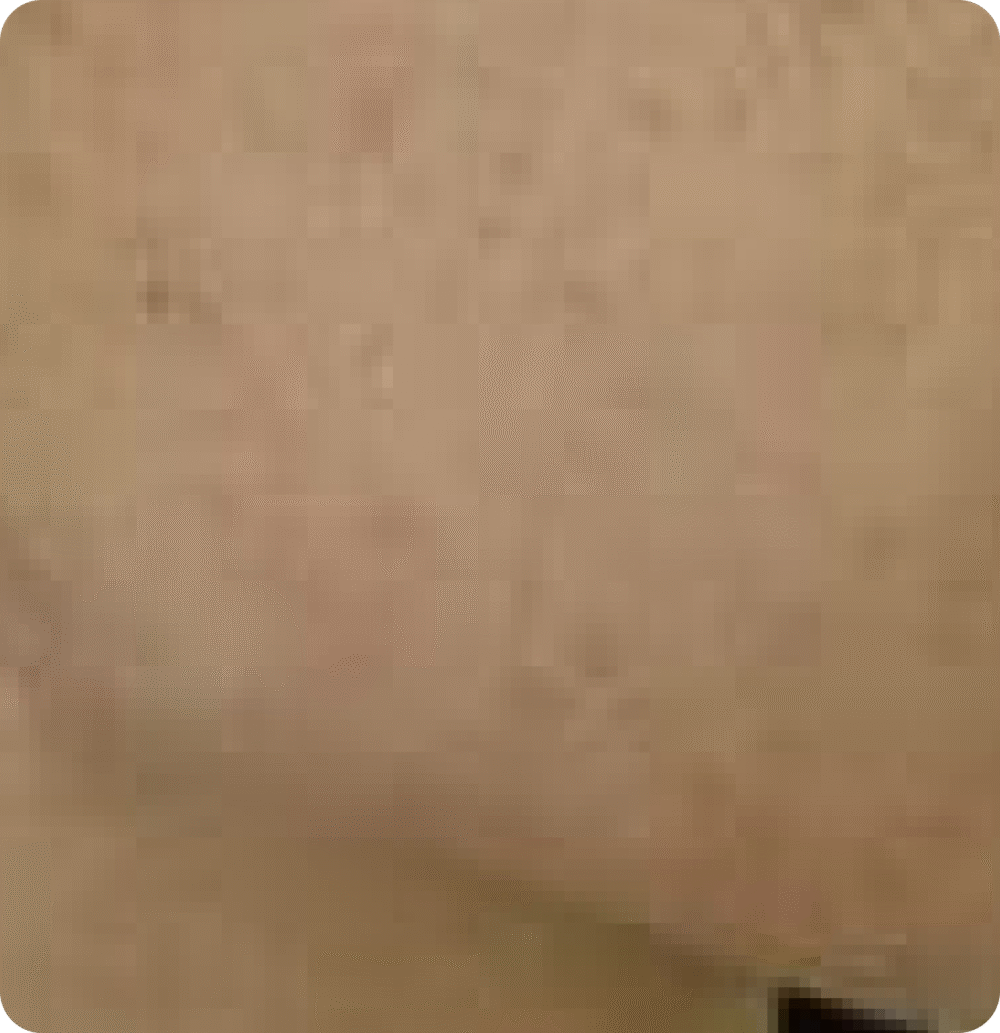 Advanced GSD IPL sPTF+ - Image 4