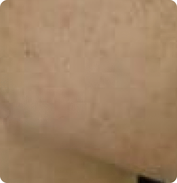 Advanced GSD IPL sPTF+ - Image 4