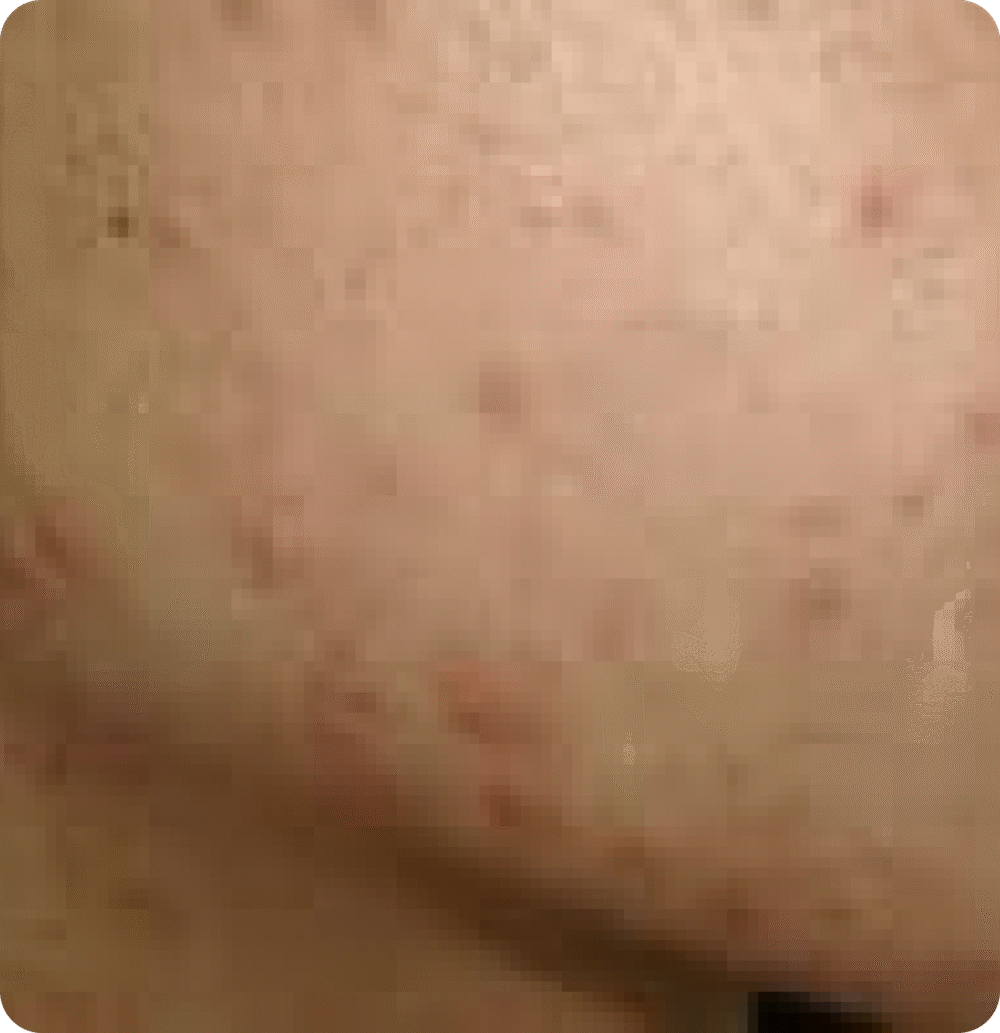 Advanced GSD IPL sPTF+ - Image 5