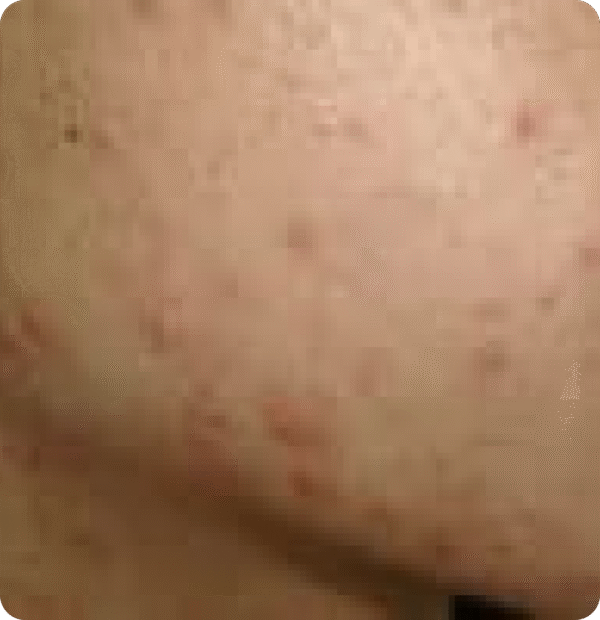 Advanced GSD IPL sPTF+ - Image 5