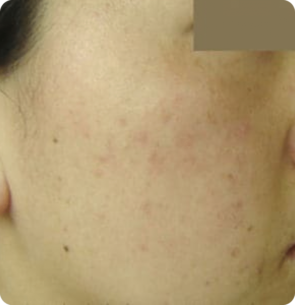 Advanced GSD IPL sPTF+ - Image 6