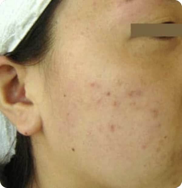 Advanced GSD IPL sPTF+ - Image 7