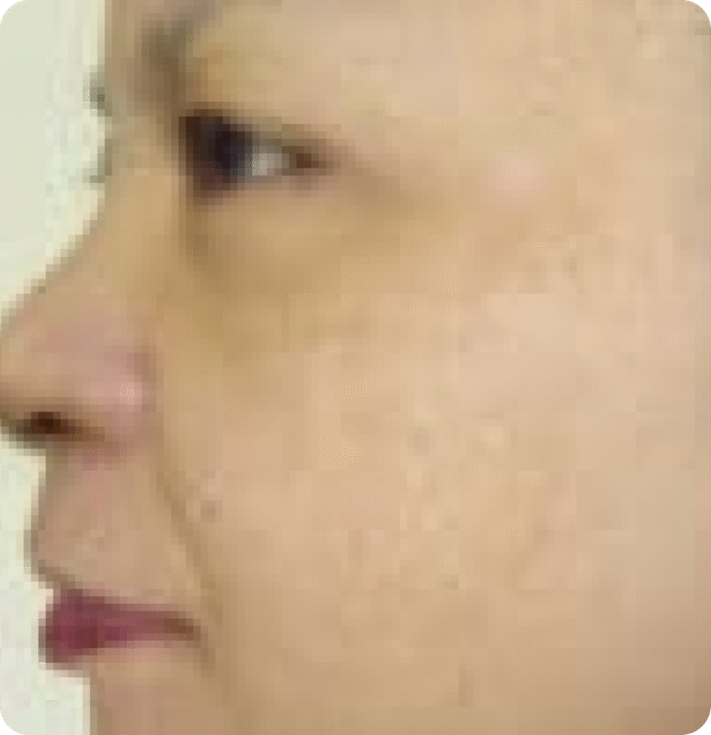 Advanced GSD IPL sPTF+ - Image 8