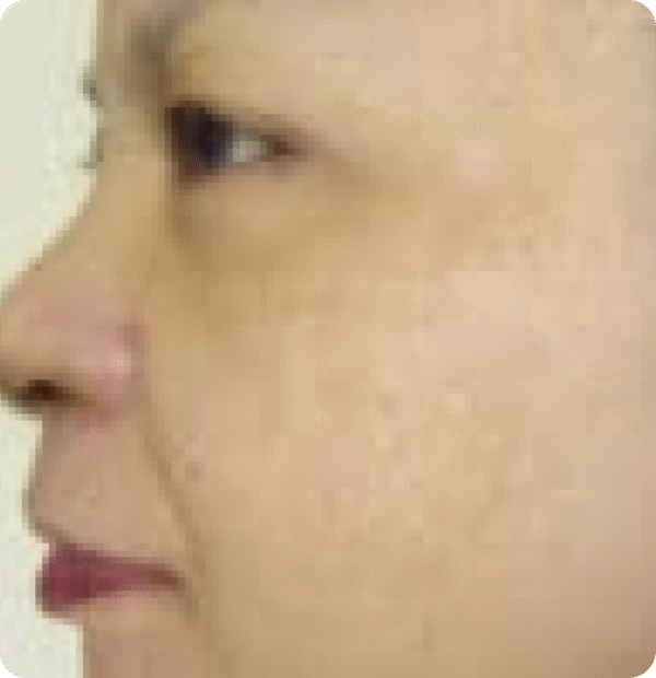 Advanced GSD IPL sPTF+ - Image 8