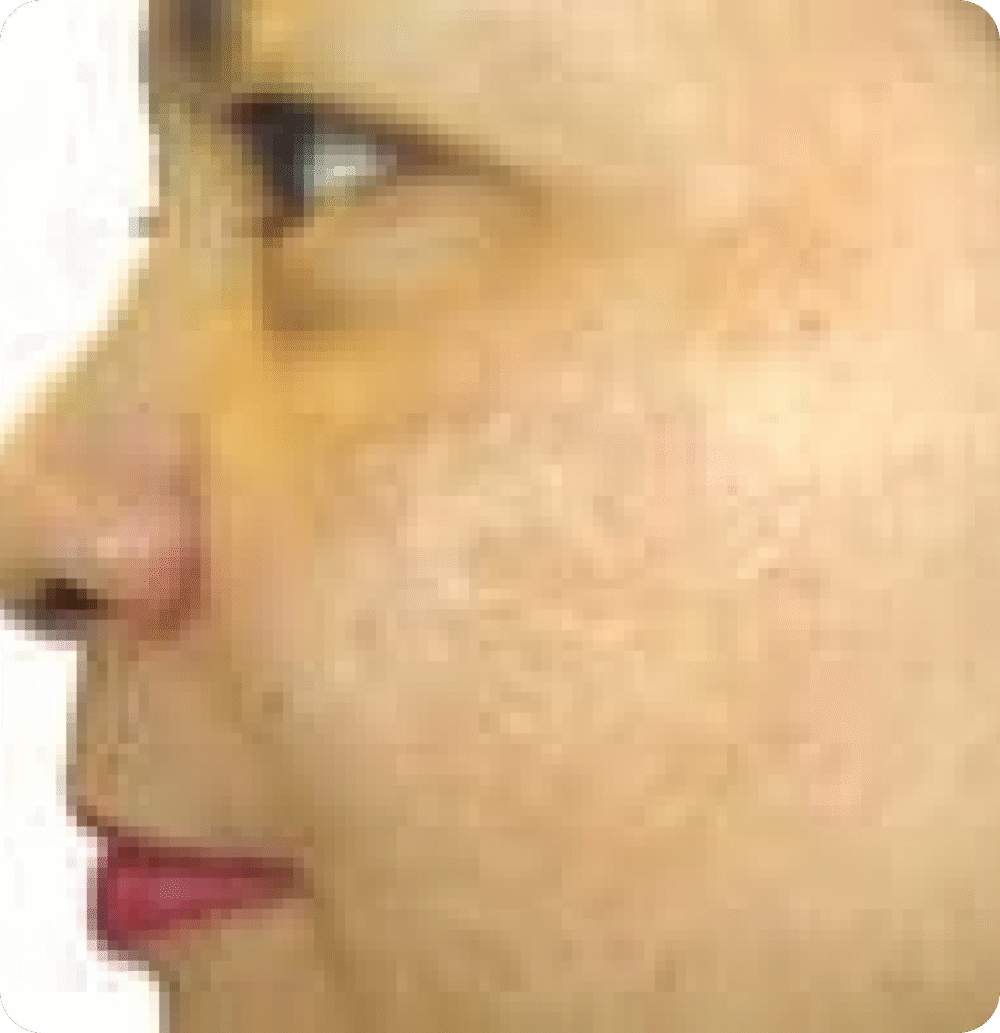 Advanced GSD IPL sPTF+ - Image 9