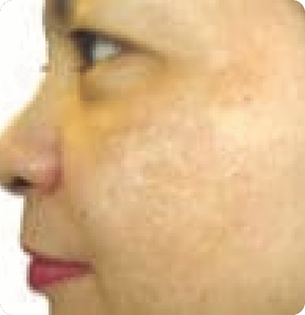 Advanced GSD IPL sPTF+ - Image 9